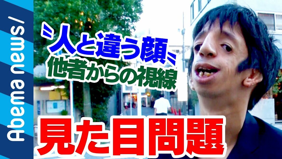 【トリーチャーコリンズ症候群】"見た目問題"石田祐貴さんが視線を浴びながらも街を歩く理由｜#アベプラ《アベマTVで放送中》
