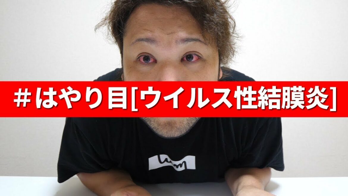 両目がウイルス性結膜炎になるとこうなります! 両目がウイルス性結膜炎になるとこうなります!