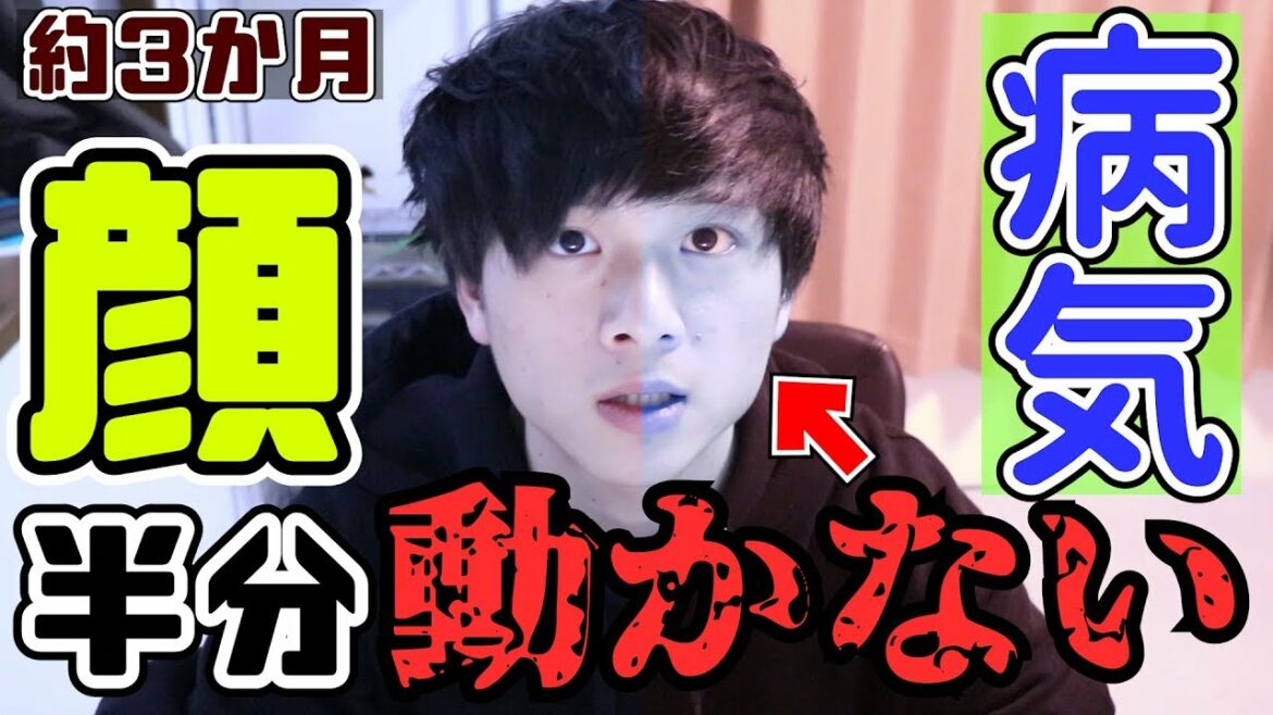 顔面神経麻痺で顔半分動かなくなった話