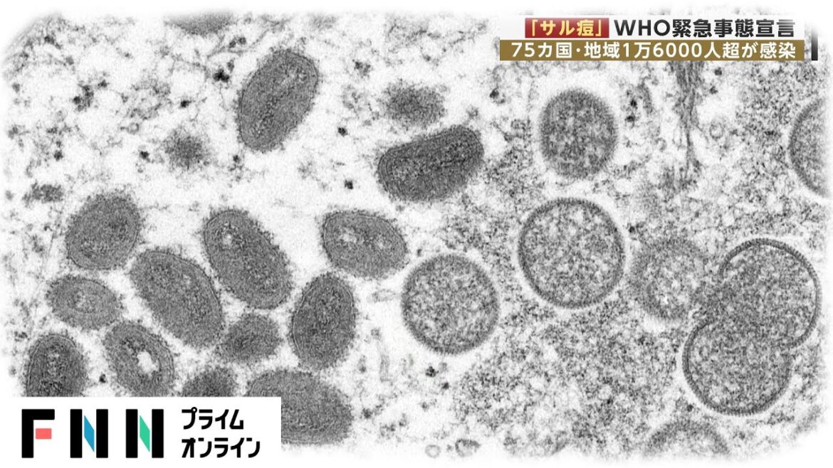 「サル痘」でWHOが緊急事態宣言　75カ国・地域で1万6000人超が感染