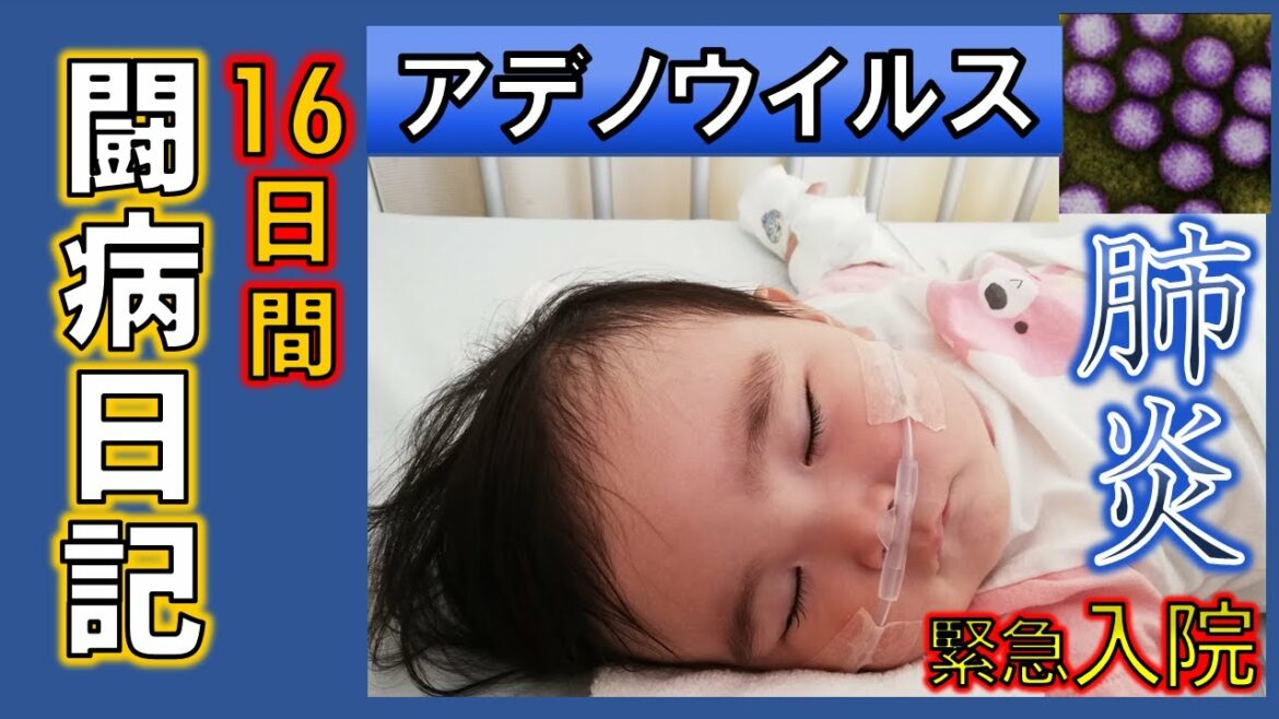 【アデノウイルス・肺炎】高熱、嘔吐、飲食拒絶、脱水、肺炎、入院/時間経過まとめ/通院もしてたのに。。。小さな命の危機【私の教訓まとめは説明欄】pneumonia 【アデノウイルス・肺炎】高熱、嘔吐、飲食拒絶、脱水、肺炎、入院/時間経過まとめ/通院もしてたのに。。。小さな命の危機【私の教訓まとめは説明欄】pneumonia