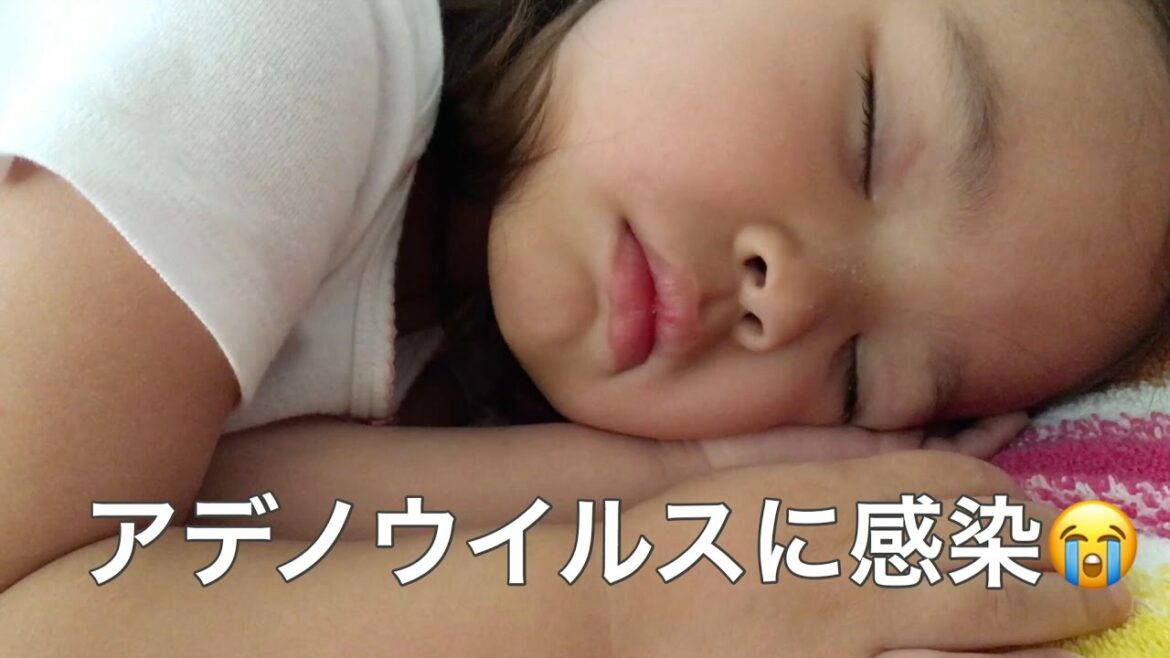 アデノウイルスに家族感染…［３兄妹］