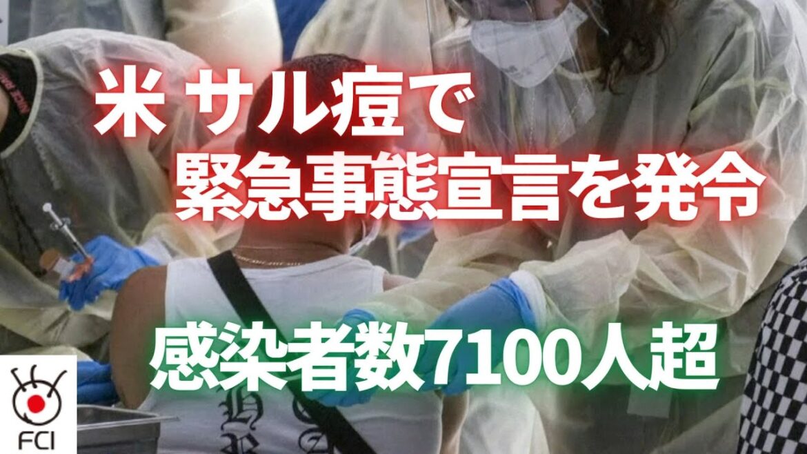 米 サル痘で緊急事態宣言を発令　感染者数7100人超