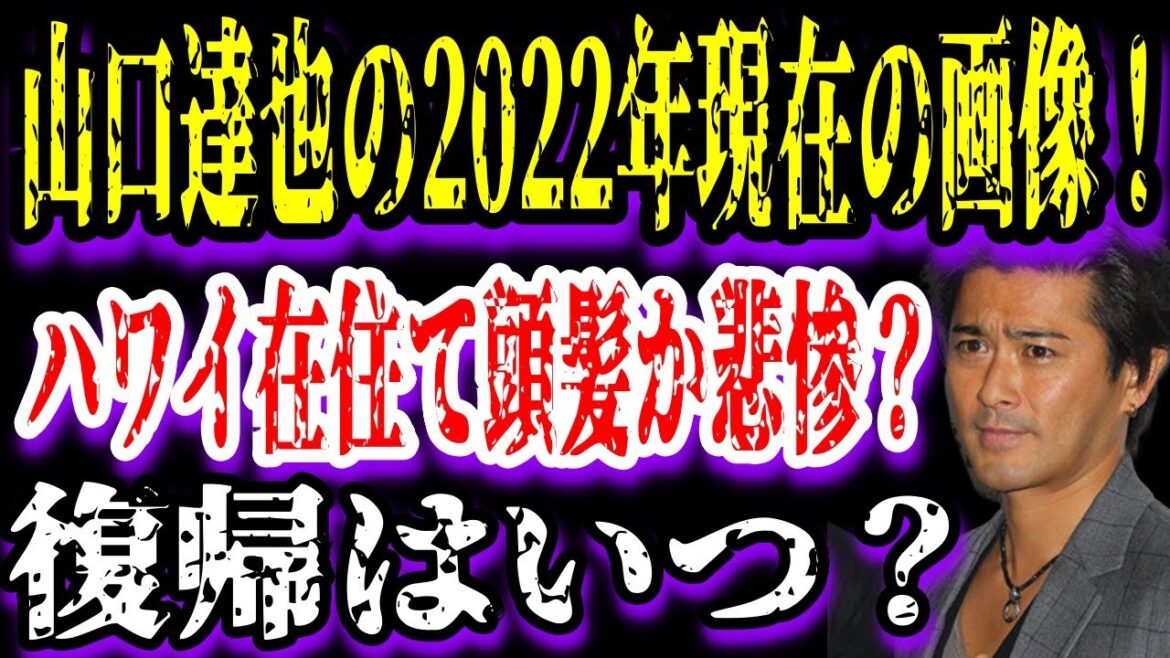 【ゆっくり解説】山口達也の2022年現在の画像！ハワイ在住で頭髪が悲惨？復帰はいつ？