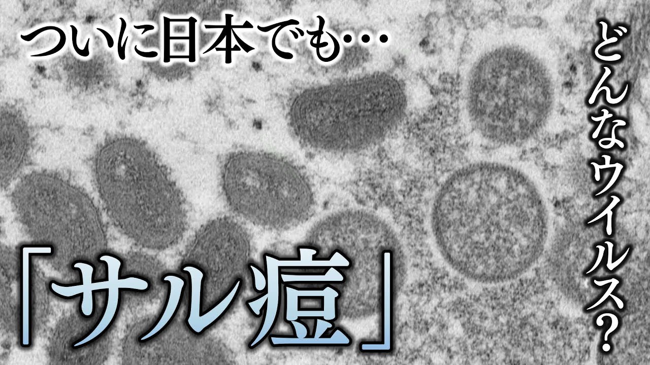 「サル痘」ってどんなウィルス? 感染経路は? 症状は? 専門家がイチから解説 - WACOCA NEWS