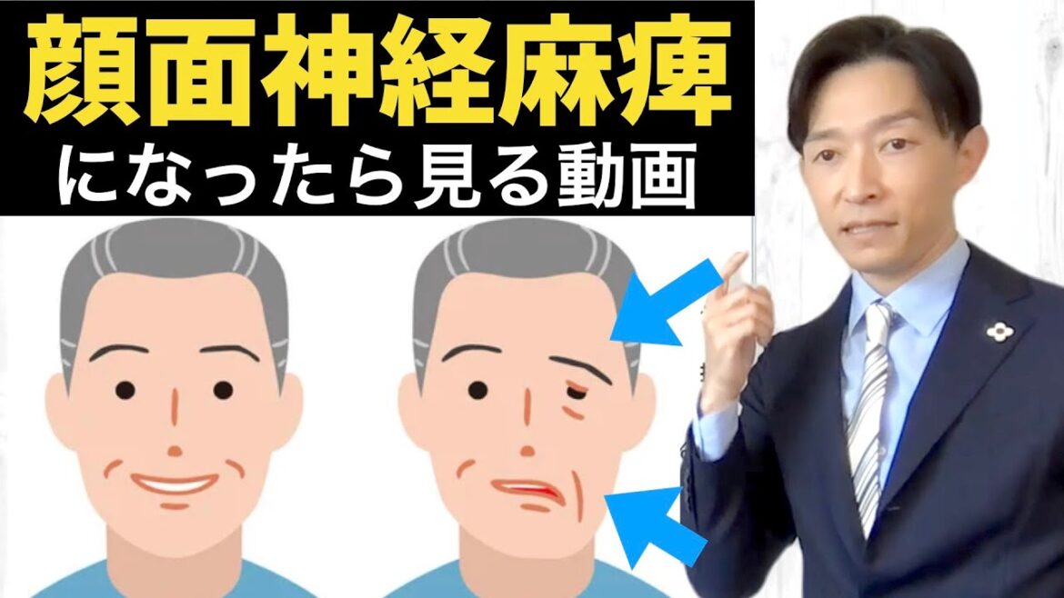 【なったらすぐ見てください】顔面神経麻痺の治療