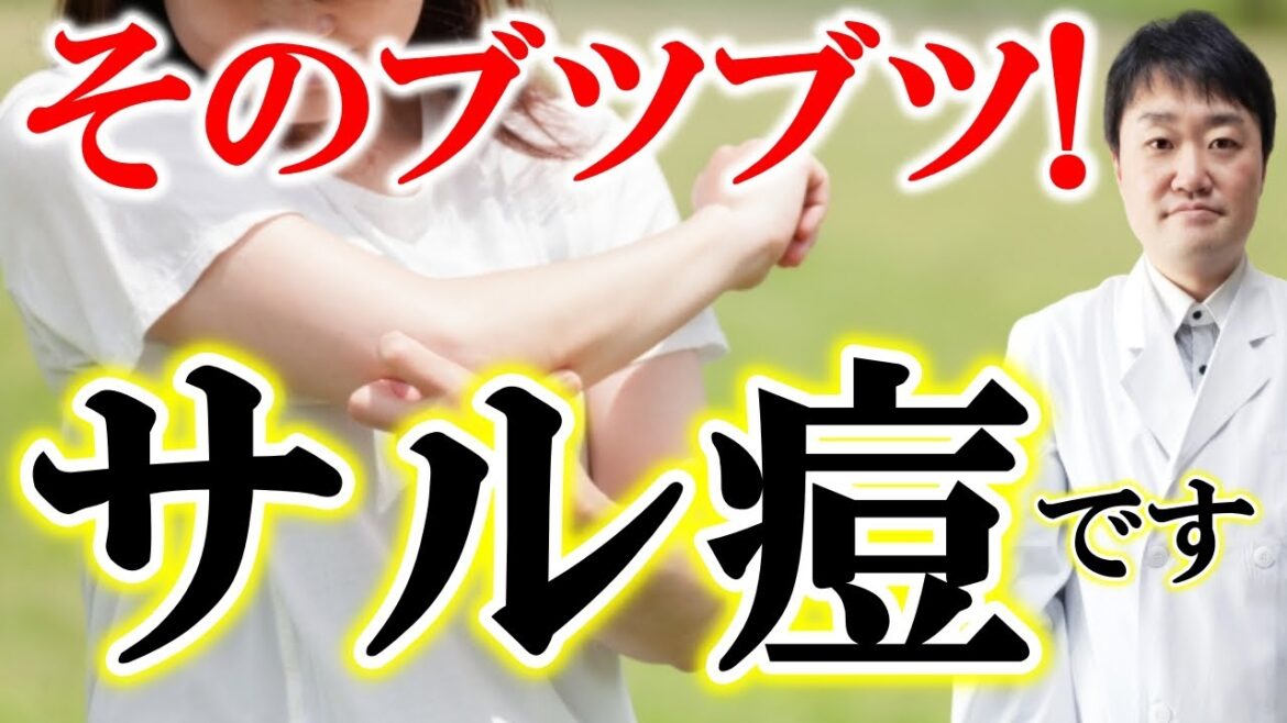 【日本初公開の画像あり】サル痘のすべて　帯状疱疹との見分け方　医師がくわしく解説