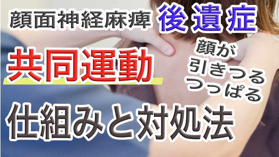【顔面麻痺 後遺症】共同運動　仕組みと対処法