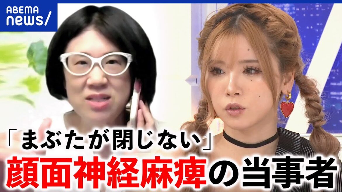 【顔面麻痺】「顔が元通りになるか怖かった」「口から水が漏れる」食事や睡眠も難しい症状は