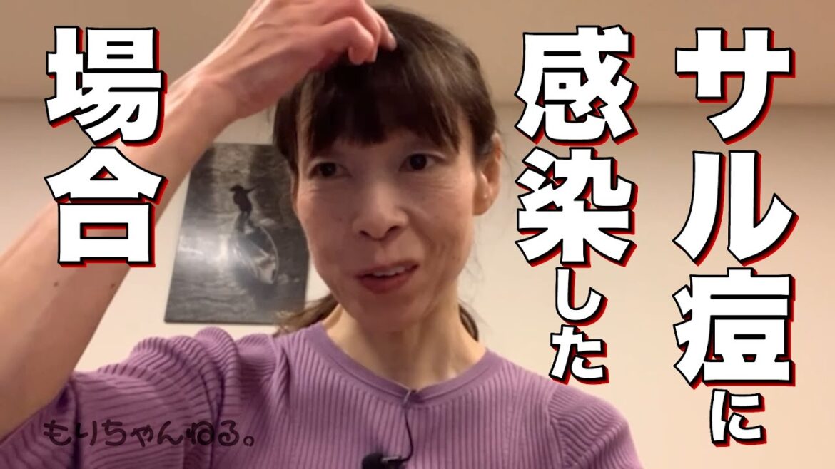 サル痘に感染した場合