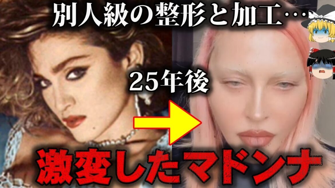 【ゆっくり解説】心の闇？マドンナの衝撃的な顔の激変をゆっくり解説