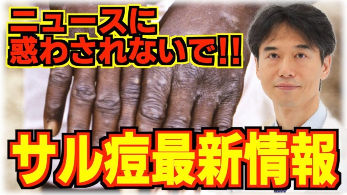【サル痘】イタズラに煽る情報に注意！論文から紐解く症状・原因・対処法、ワクチンについて解説します！