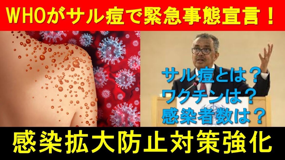 WHOがサル痘で緊急事態宣言！感染拡大防止対策強化する。そもそもサル痘とは？ワクチンはあるの？感染者数はどれくらい？を解説します！