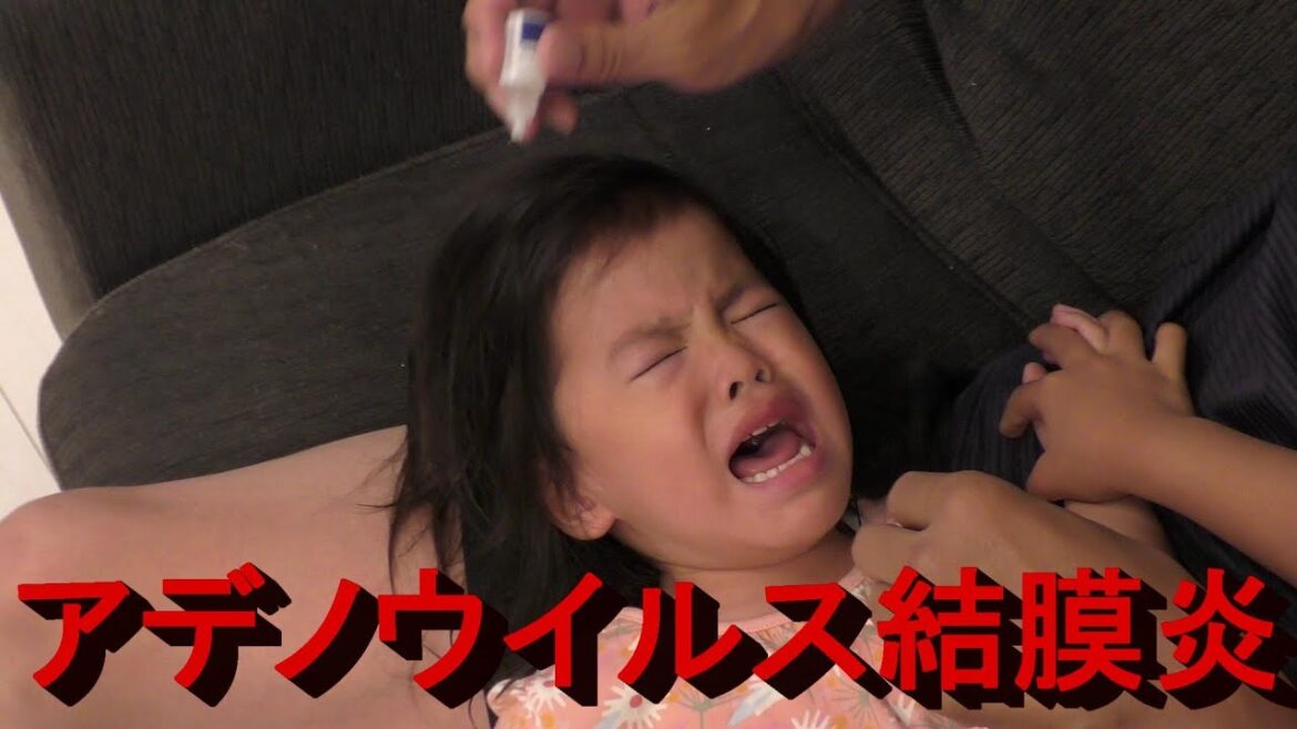 アデノウイルス結膜炎