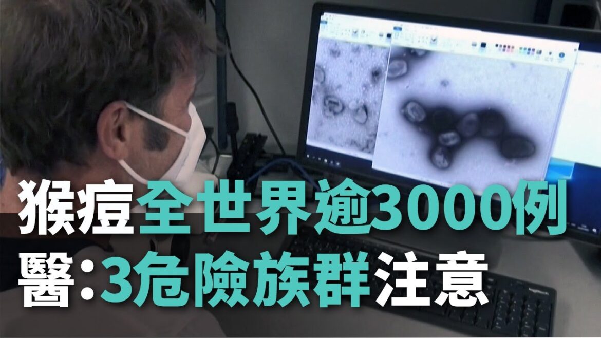 サル痘感染者世界で3000例超、医師：3大リスク群は注意が必要