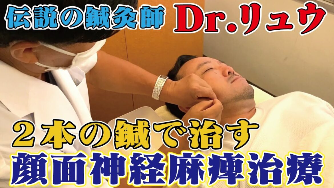 顔面神経麻痺 治療の様子を公開!2本の鍼で治療! 顔面神経麻痺 治療の様子を公開!2本の鍼で治療!