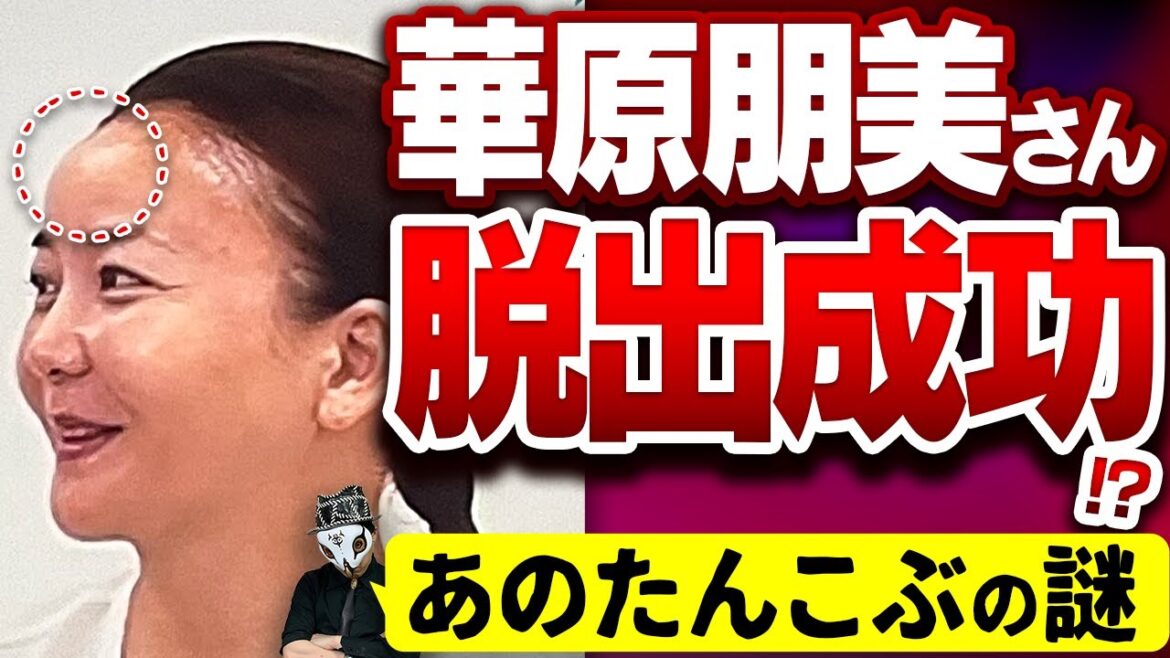 【離婚報道】華原朋美さん、無事に元旦那から脱出成功か？おでこのたんこぶの謎が・・・