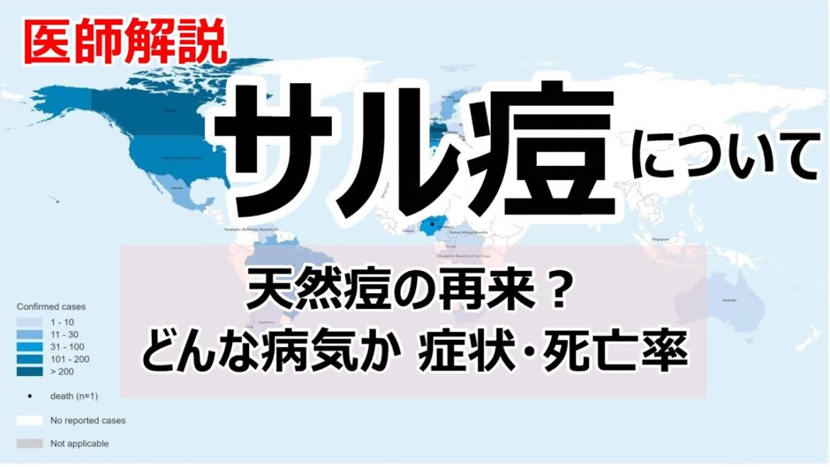 サル痘とはどんな病気なのか?症状や感染経路など解説します サル痘とはどんな病気なのか?症状や感染経路など解説します