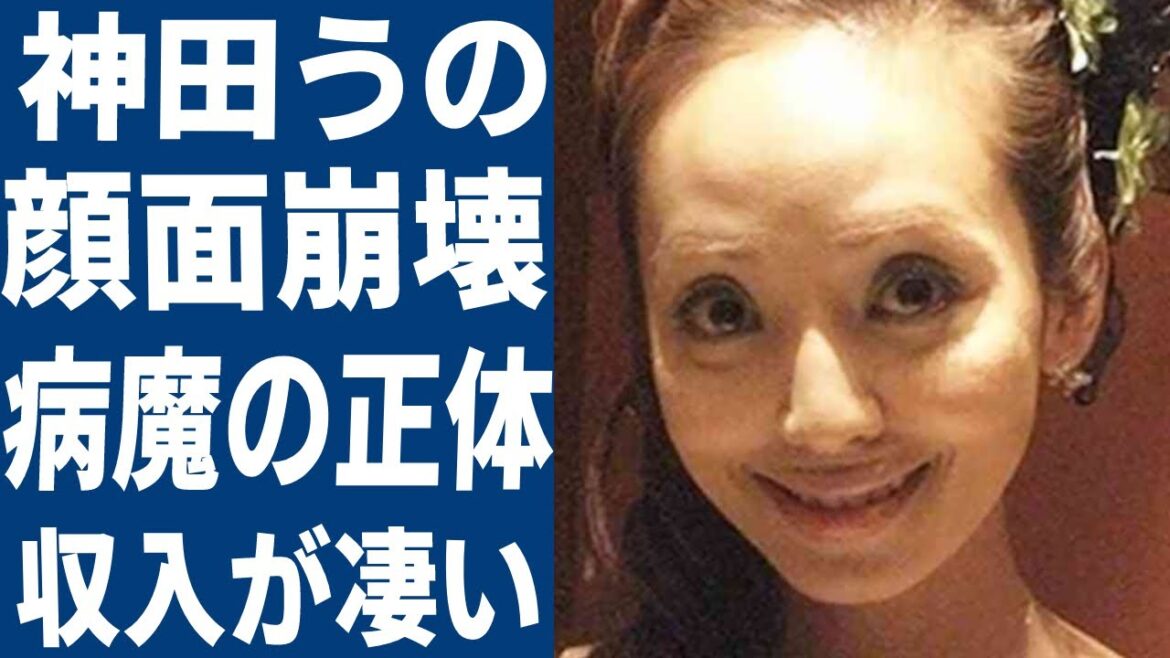 神田うのの整形で顔面崩壊したと言われやる現在の姿に言葉を失う…セレブなイメージが強い女性タレントの難病の正体や旦那の資産額に度肝を抜かれた！