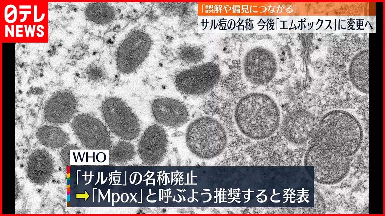 【サル痘の名称】今後「エムポックス」に変更へ…「誤解や偏見に…」 - WACOCA NEWS