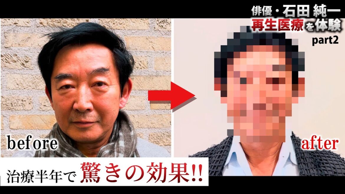 【衝撃の結果公開！】石田純一が最先端医療『再生医療』を体験!!【後編】