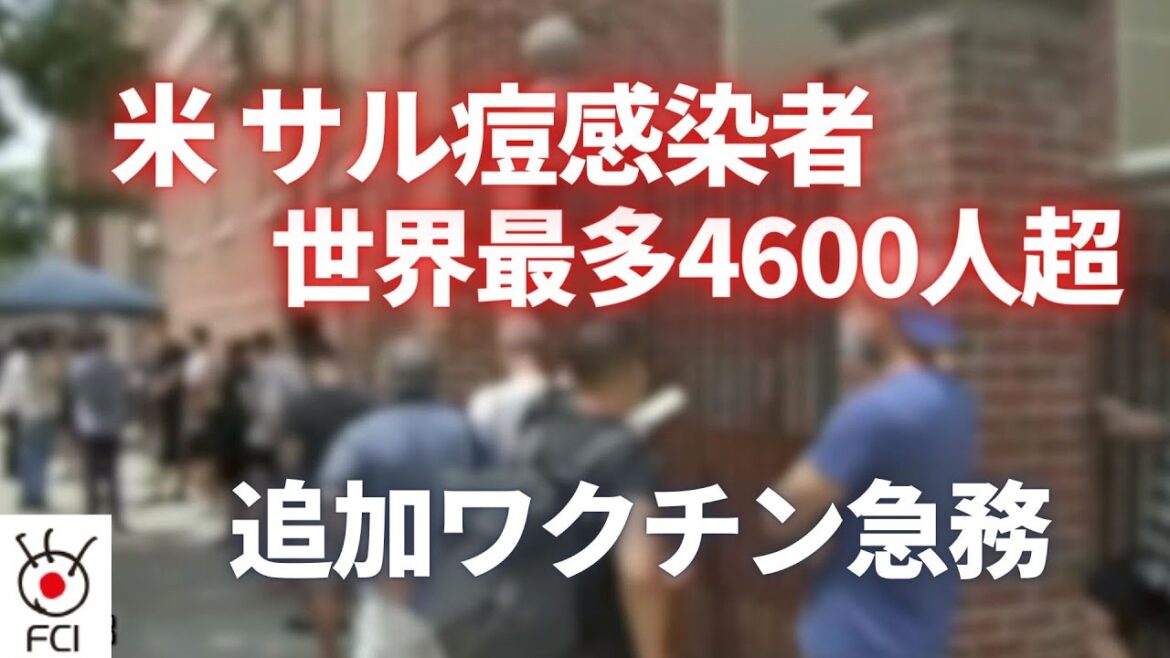 米サル痘感染者数 4600人超で世界最多