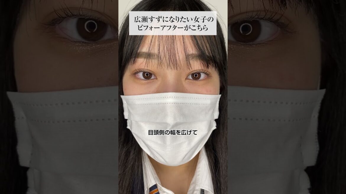 広瀬すずになりたい女子の整形ビフォーアフターがこちら#shorts