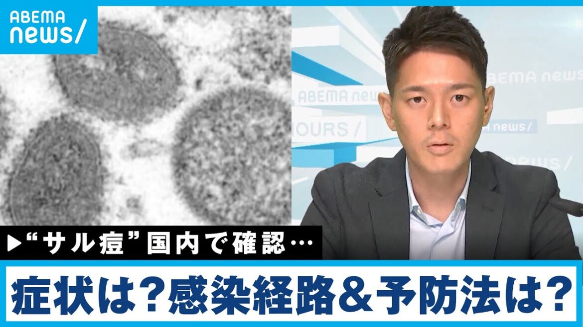 【サル痘】国内でも確認…飛沫感染はする？予防法は？徹底解説｜厚労省担当 松本拓也記者
