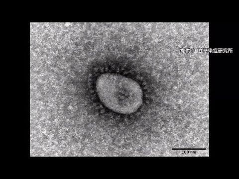 オミクロン株「XBB.1・5」系統 広島県内で初確認 新型コロナ (2023/04/12 17:55) オミクロン株「XBB.1・5」系統 広島県内で初確認 新型コロナ (2023/04/12 17:55)