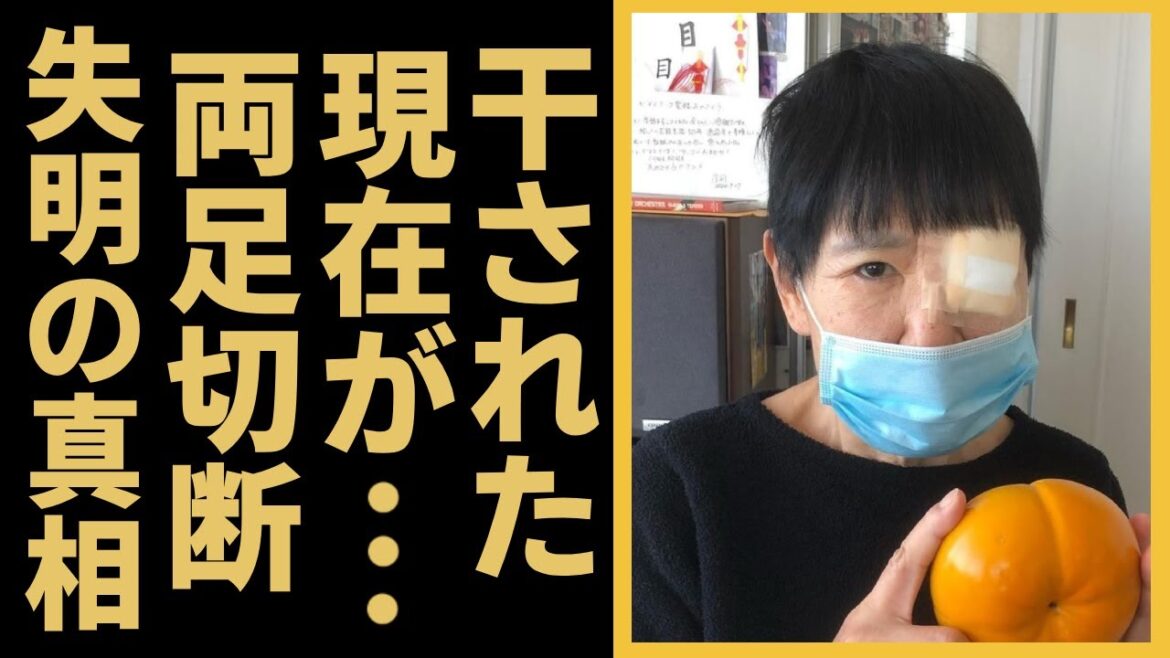 和田アキ子が芸能界から干された理由や車椅子生活の現在に言葉を失う...『あの鐘を鳴らすのはあなた』で有名な紅白歌手の“失明”の真相や本当の国籍に驚きを隠さない...
