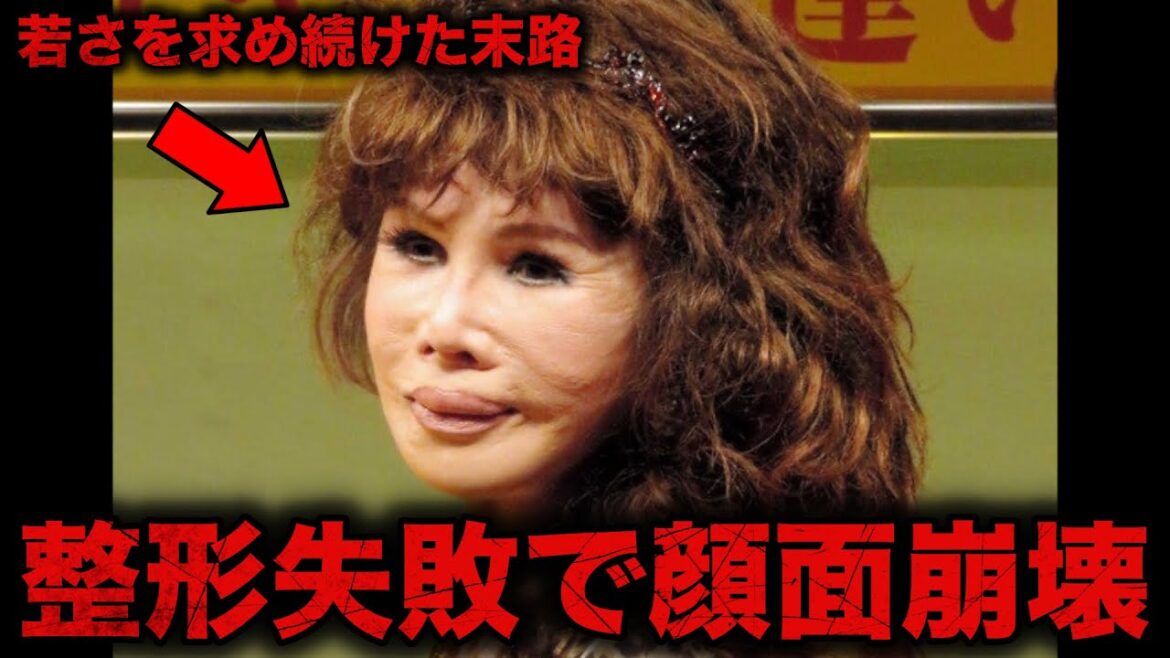 整形のしすぎでヤバいほど顔面が崩壊した芸能人7選