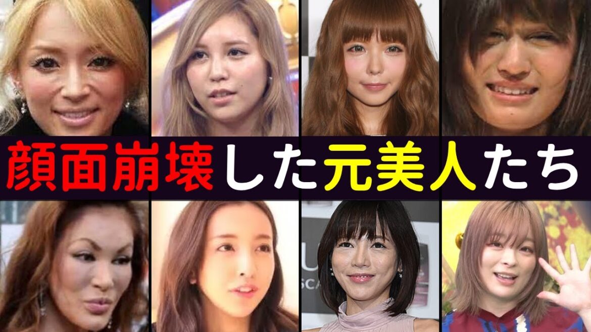 顔面崩壊した元美人の芸能人たち パート２