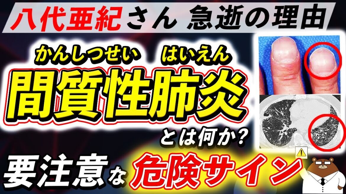 放置厳禁！知らないと後悔する「間質性肺炎」が引き起こす体の変化。コロナとの関係、超意外な原因は？なぜ八代亜紀さんは急逝したのか。初期の危険サインとは？医師が徹底解説！