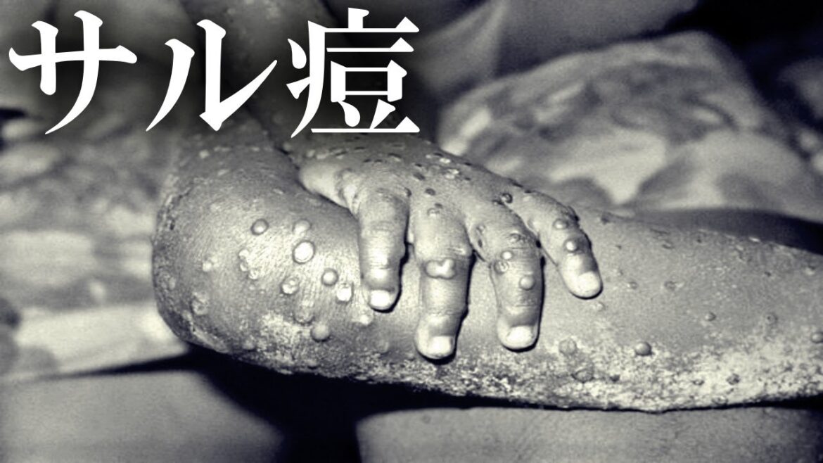 【ゆっくり解説】謎のウイルスサル痘とは【雑学】【WHO】【ニュース】