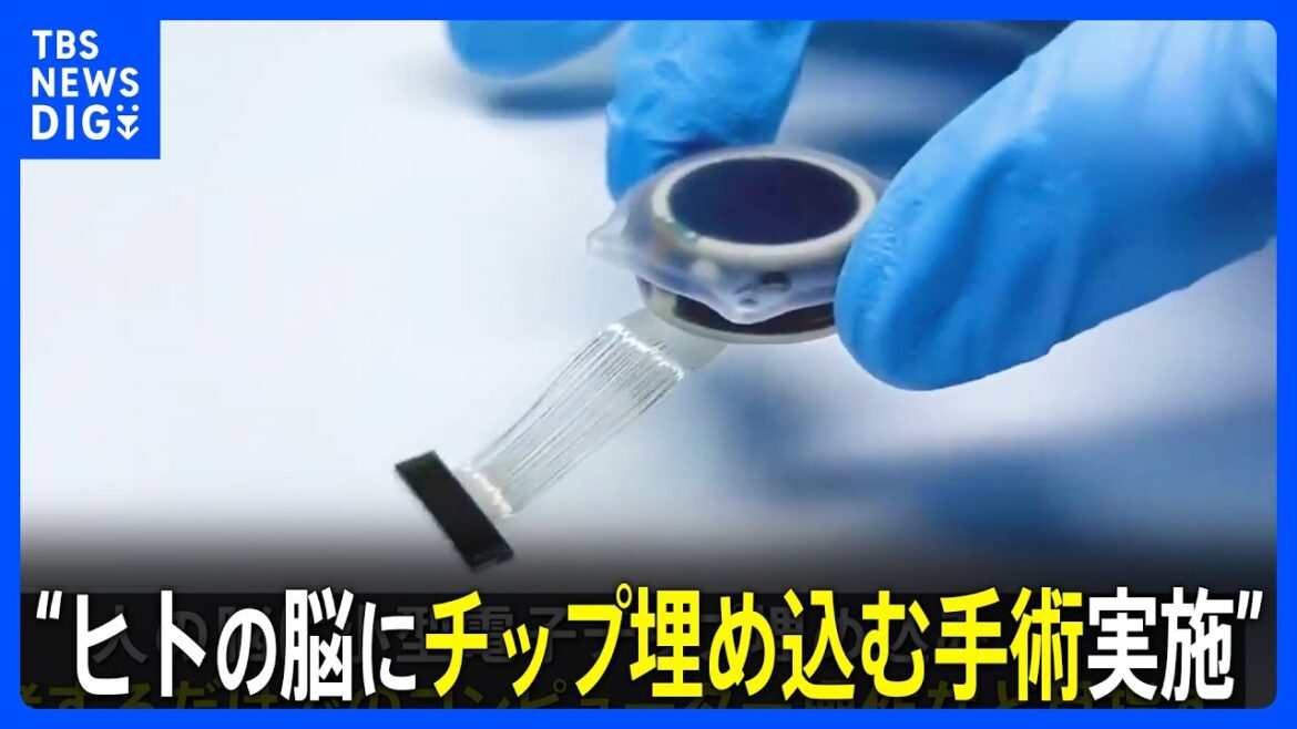 ヒト対象の脳インプラントを初実施…イーロン・マスク氏設立の「ニューラリンク」｜TBS NEWS DIG