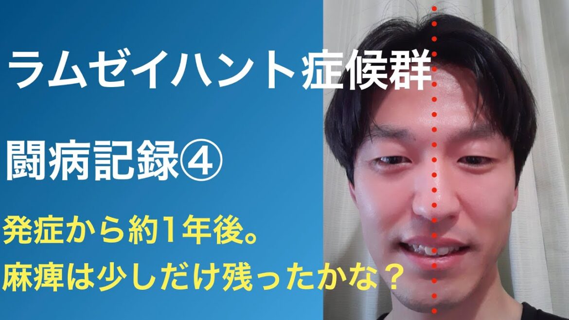 ラムゼイハント症候群　闘病記録④