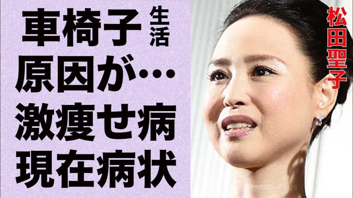松田聖子が車椅子生活になった原因…激痩せした病気の現在の病状に言葉を失う…「赤いスイートピー」でも有名な歌手に引退説がでる理由に驚きを隠せない…