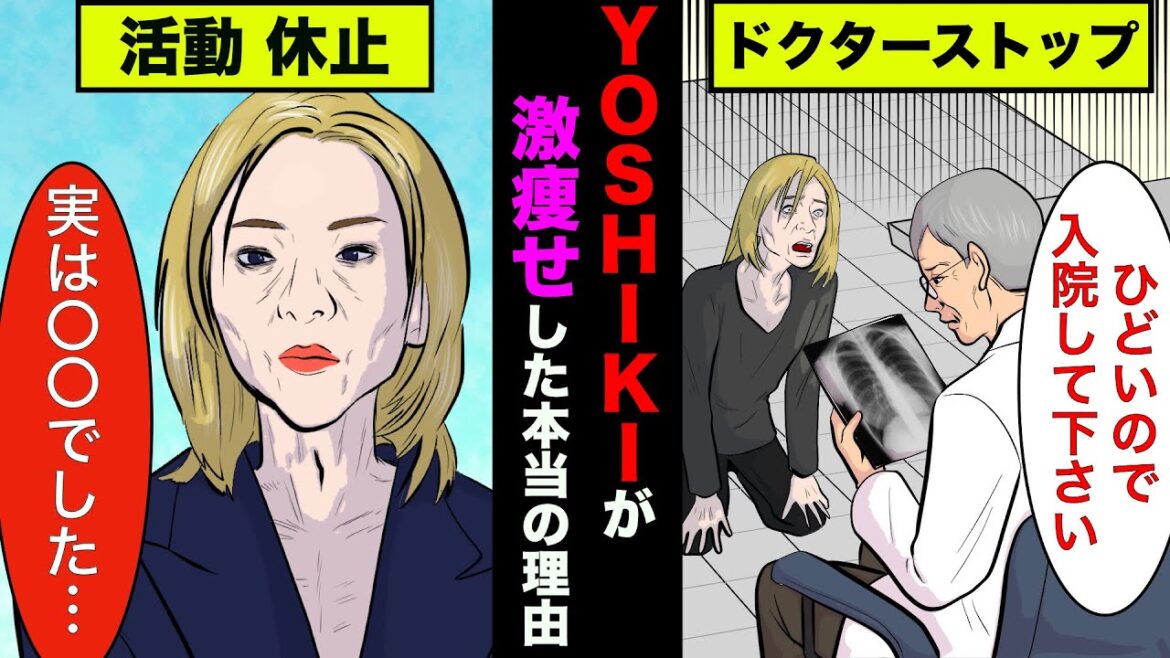 YOSHIKIが激痩せして療養する本当の理由！今後の活動もドクターストップで中止に【アニメ】【漫画】【実話】