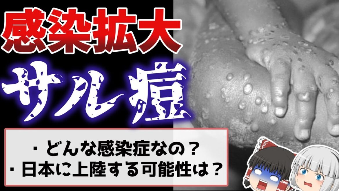 欧米諸国で感染拡大の『サル痘』とは？【ゆっくり解説】