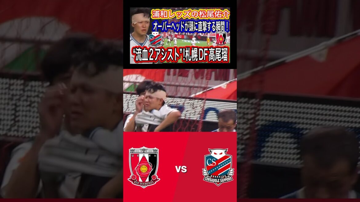 ⭕️浦和レッズ松尾佑介のオーバーヘッドが直撃する決定なシーン！ “流血2アシスト”!札幌DF高尾瑠「僕のパスで武蔵君が決めたのが嬉しい浦和レッズ対北海道コンサドーレ札幌！明治安田Ｊ１