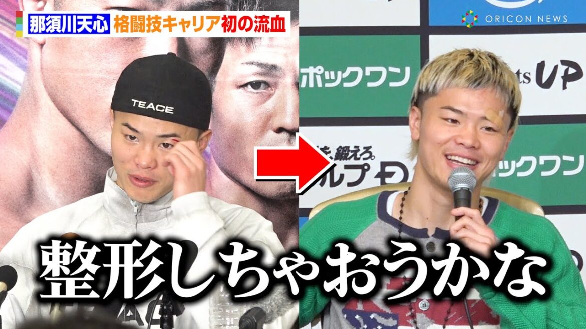 那須川天心、人生初のカットで“左目傷”の縫合は断固拒否！？「整形しちゃおうかな」　『Prime Video Boxing 10』一夜明け会見