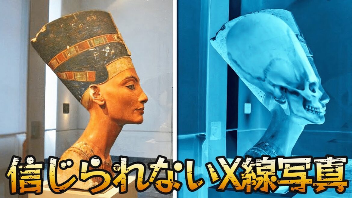 【衝撃映像】科学者も戦慄...！信じられないX線写真15選。36年妊娠した男性？体内で成長する木！？#X線の謎 #医学的驚異 #ミステリー #人体の謎 #考古学 #未解明現象 #医学史