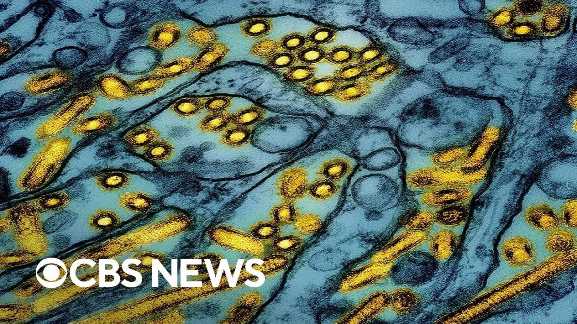 Severe human U.S. case of H5N1 bird flu, California declares emergency Severe human U.S. case of H5N1 bird flu, California declares emergency