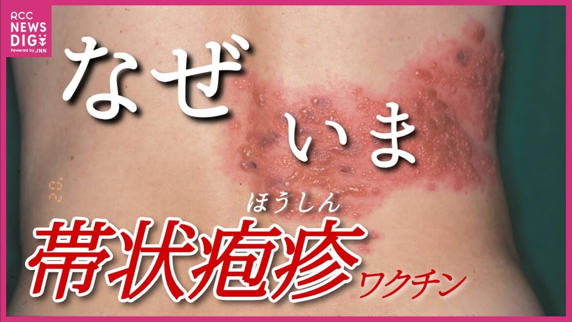 なぜ必要に？「帯状疱疹」ワクチンが今年度から定期接種化　予防したいのはよりツライ「後遺症」　“水疱瘡が減って帯状疱疹は増加” その背景は