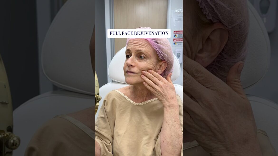 COVID Aged Me! 😓 Facelift Brought Her Back to Life! 🤯