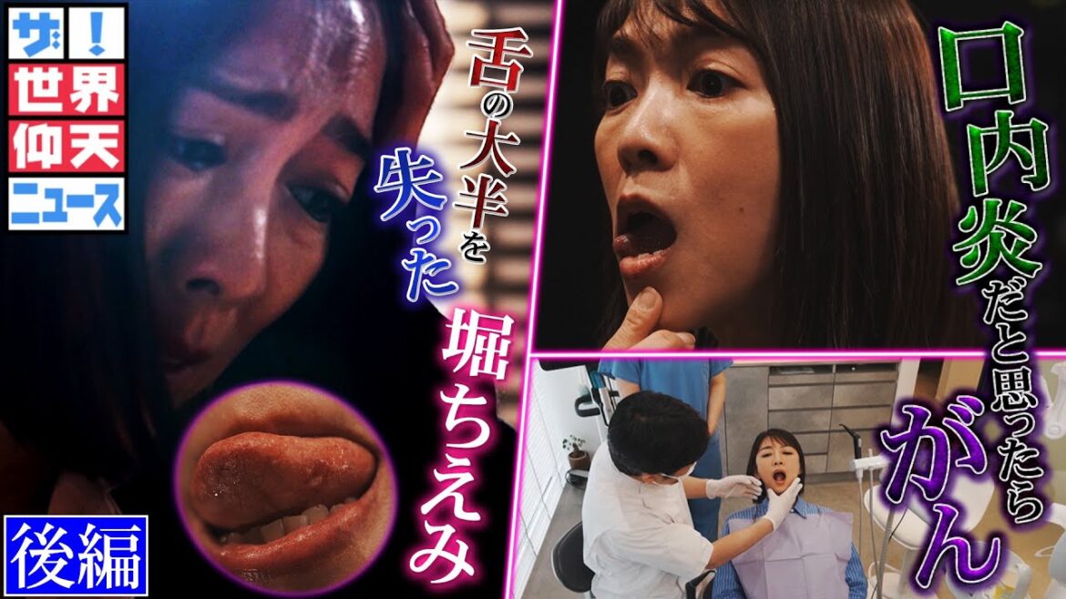 治らない口内炎…実はステージ４のがんだった　舌の大半を失った堀ちえみ（後編）【ザ！世界仰天ニュース】