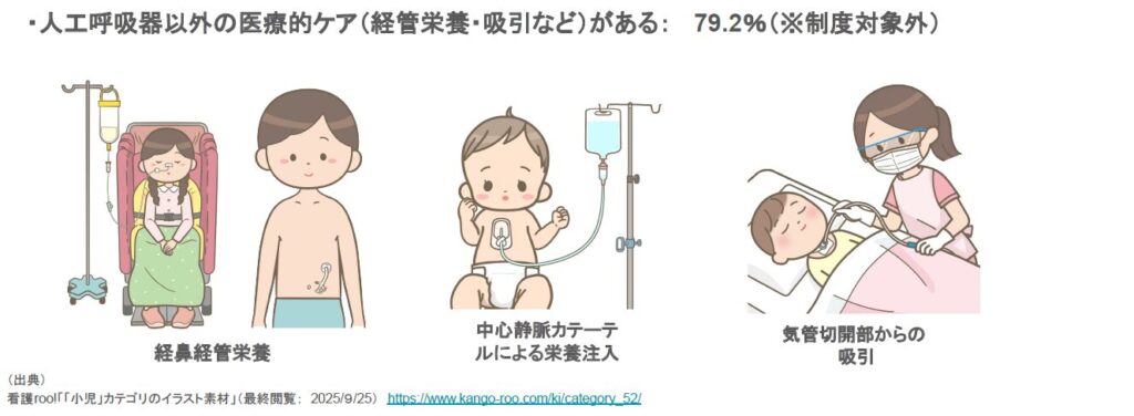 経鼻経管栄養、中心静脈カテーテルによる栄養注入、気管切開部からの吸引のイラスト