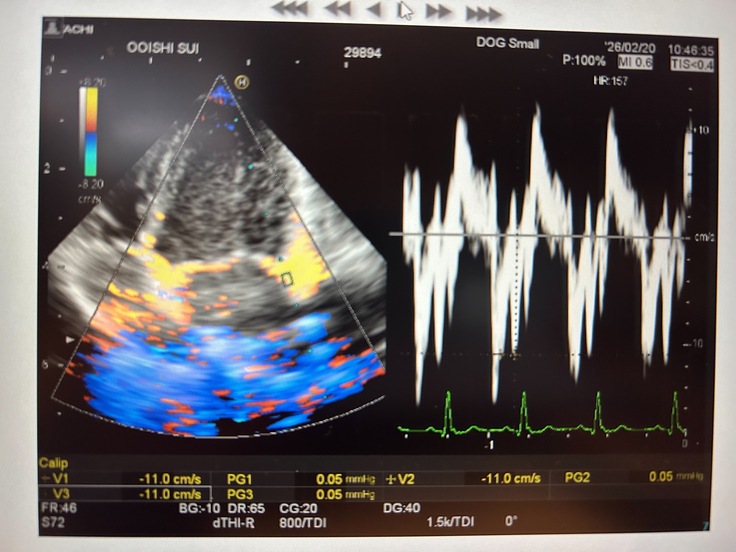 心エコー②